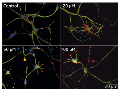 Impact of Mn2+ on the morphology of hippocampal neurons.