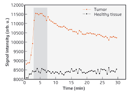 Temporal evolution of the MRI signal in tumour