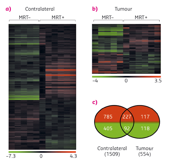 Influence of MRT on gene expression