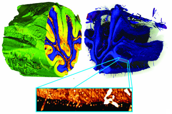 Three-dimensional false-colour renderings of a human cerebellum