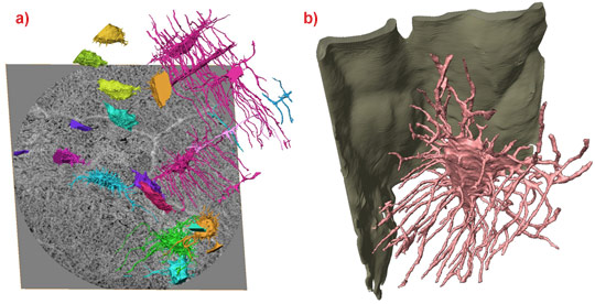 Ultrastructural bone features rendered in 3D